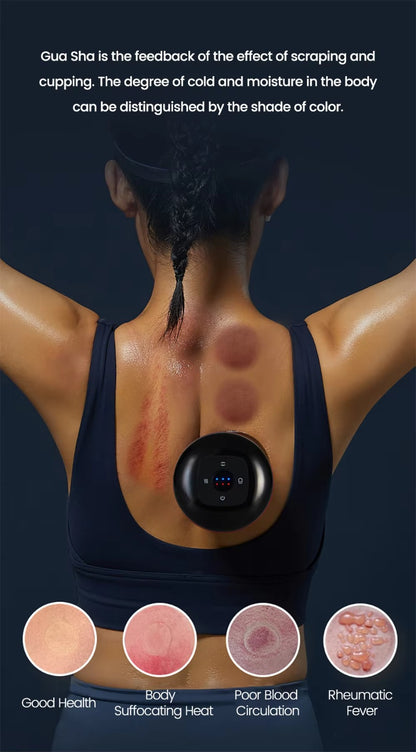 Electric Cupping & Fat Burning Massager